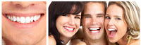 implantes de dentes